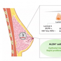 影響因子12.31！中國專家提出乳腺癌腫瘤干細(xì)胞治療開拓性研究視角